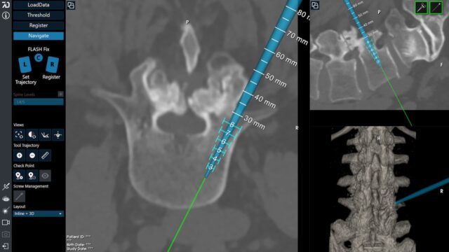 7D Surgical Spine Navigation Screenshot